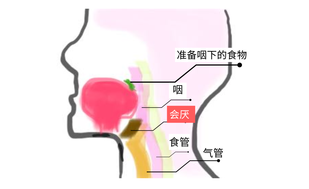 会厌炎