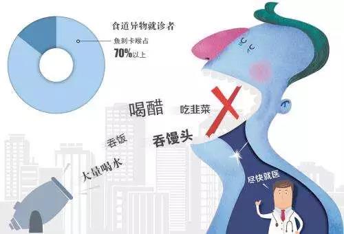 嗓子卡鱼刺