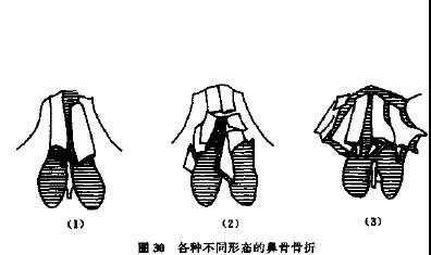 重庆耳鼻喉科急诊医院