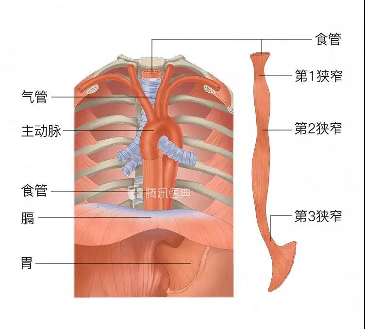 鱼刺卡住了该怎么做