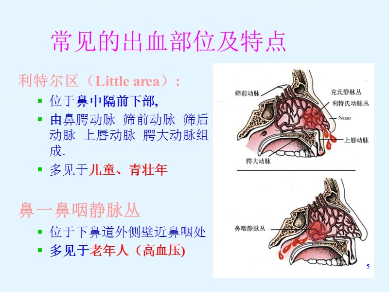 鼻出血